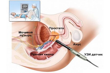 Простамол для мужчин отзывы