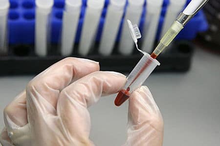 Свечи при аденоме простаты лечение