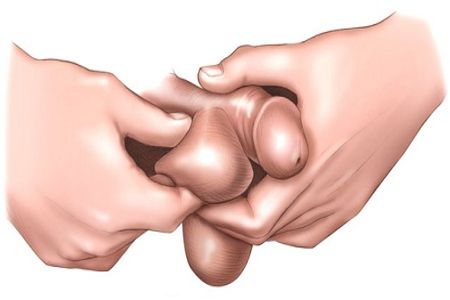Рисунок, изображающий пальпацию яичка Рисунок, изображающий пальпацию яичка