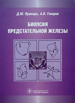 Обложка книги Биопсия предстательной железы – Пушкарь Д.Ю.