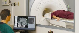 Какие заболевания выявляет МРТ головы