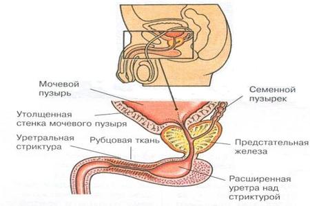 Структура уретры в разрезе
