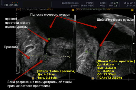 Расшифрованная картинка с монитора УЗИ Расшифрованная картинка с монитора УЗИ